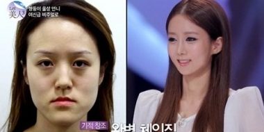 韓国美容整形医師が教える 韓国美容整形の費用相場をパーツ別に解説 Kban ケイバン